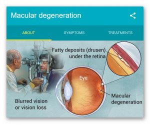 Age Realted Macualr Degeneration